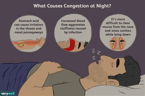 How long does a stuffy nose last?