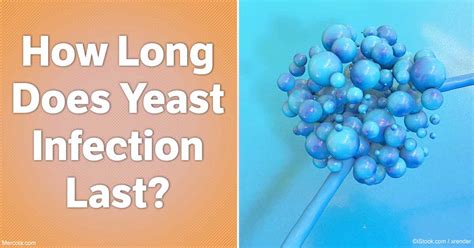 How long does a yeast infection last?