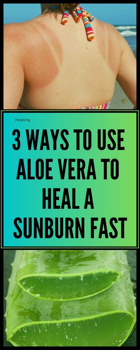 How long does aloe vera take to heal sunburn?