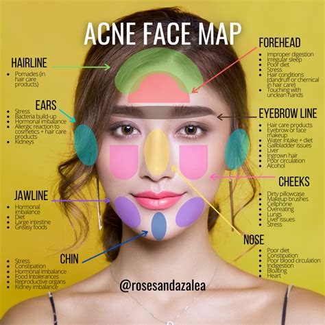 How long does anxiety acne last?