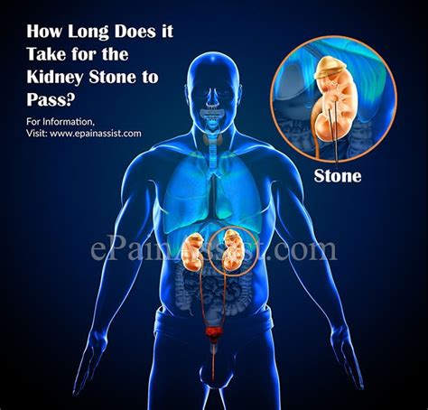 How long does blood last on stone?