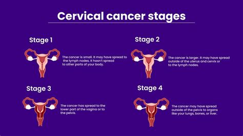 How long does cervical cancer take to fully develop?