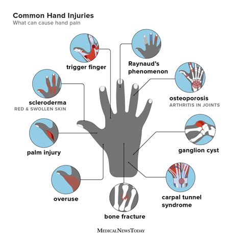 How long does finger trauma last?
