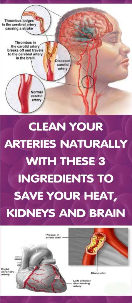 How long does it take K2 to clean arteries?