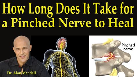 How long does it take for C6 nerve to heal?