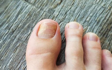 How long does it take for a big toenail to grow back?