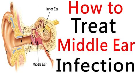 How long does it take for a infected ear to heal?