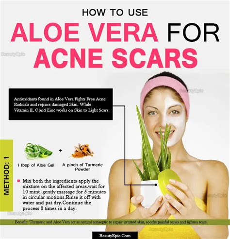 How long does it take for aloe vera to work on acne?