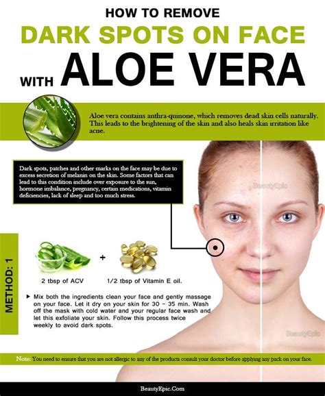 How long does it take for aloe vera to work on dark spots?