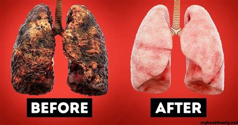 How long does it take for an ex smokers lungs to clear?