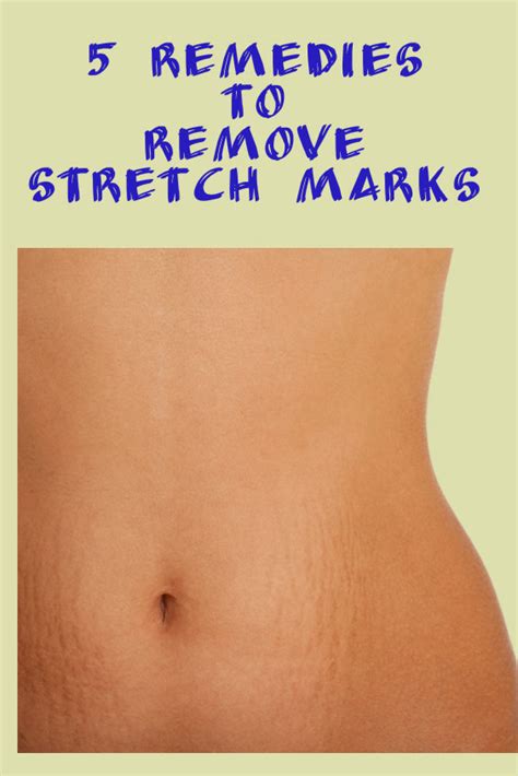 How long does it take for argan oil to get rid of stretch marks?