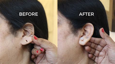 How long does it take for earring holes to heal?