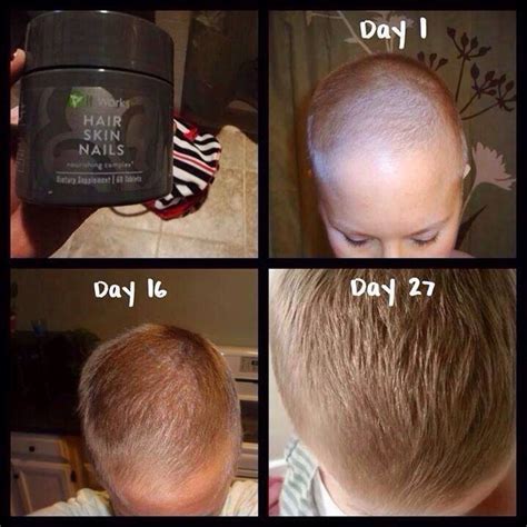 How long does it take for hair to grow back after zinc deficiency?