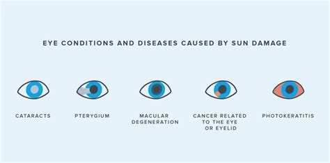 How long does it take for light to damage your eyes?