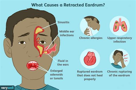 How long does it take for mucus in ear to go away?