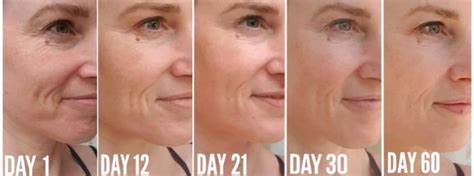 How long does it take for wrinkles to fade?