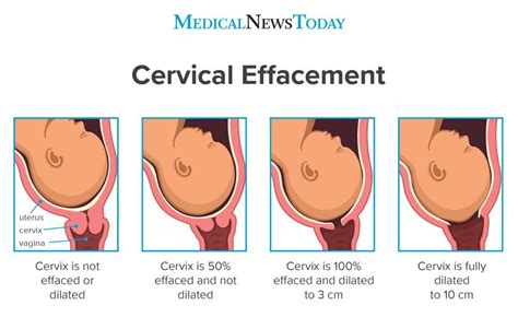 How long does it take for your cervix to close after birth?