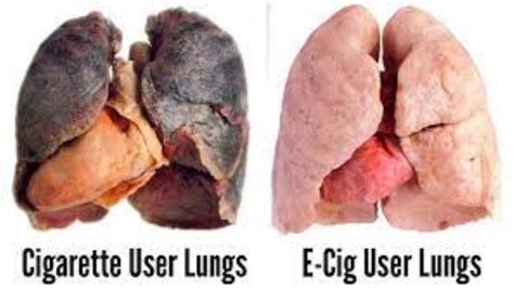 How long does it take for your lungs to heal from vaping?