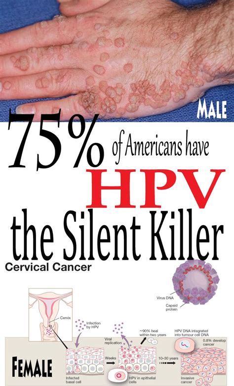 How long does it take to flush out HPV?