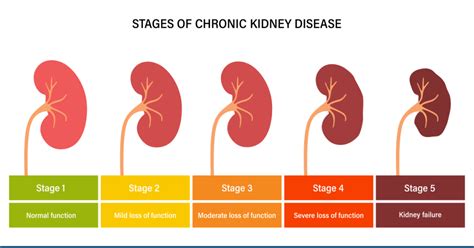 How long does it take to go from stage 4 to stage 5 kidney disease?