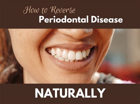 How long does it take to reverse periodontal disease?