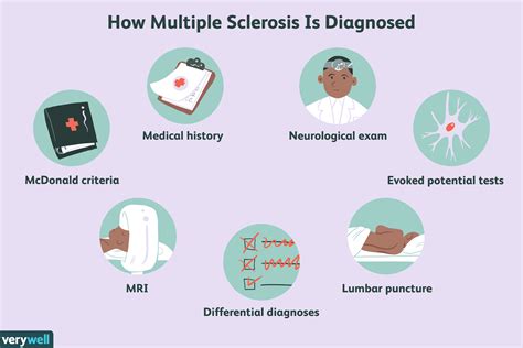 How long does it usually take to diagnose MS?