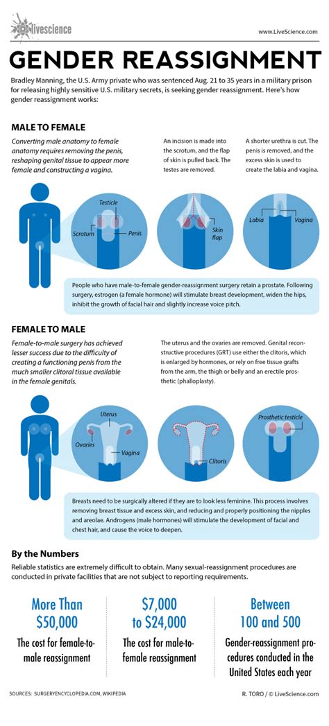 How long does male to female bottom surgery take?