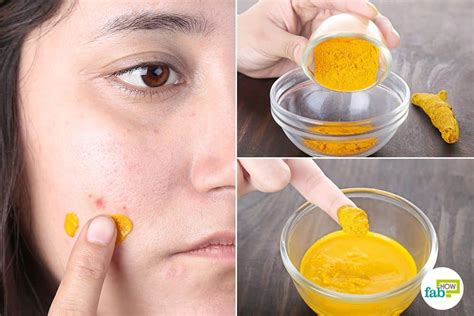 How long does turmeric take to remove dark spots?