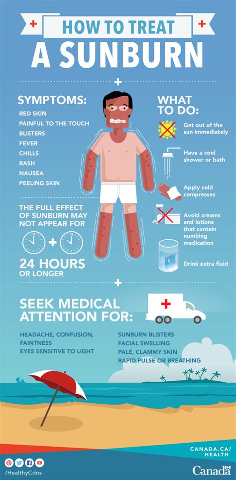 How long is a bad sunburn?