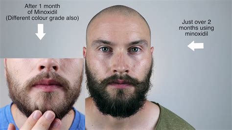 How long is a beard after 2 months?