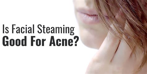 How long should I steam my face for acne?