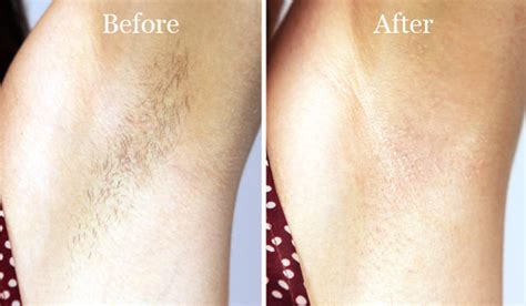 How long should armpit hair be?