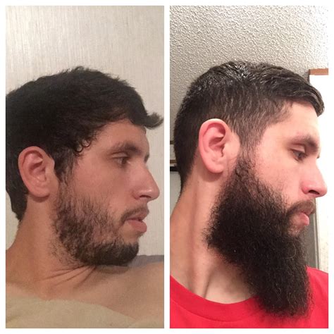 How long will a beard be in 2 years?
