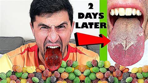 How long will my tongue hurt after eating sour candy?