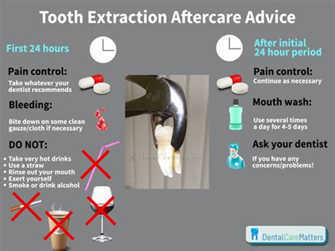 How many days after tooth extraction will it stop hurting?