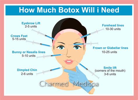 How many times a year is it safe to get Botox?