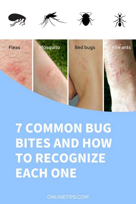 How many times can 1 flea bite you?