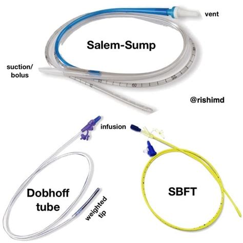 How many types of NG tube are there?