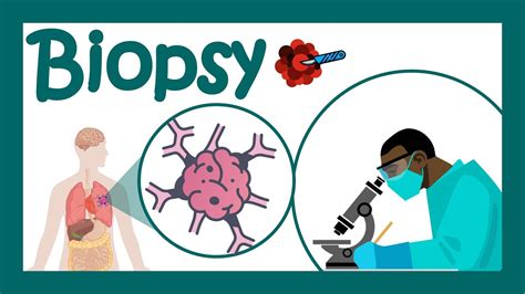 How many types of biopsy are there?