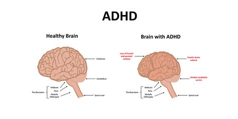How many years behind are ADHD brains?
