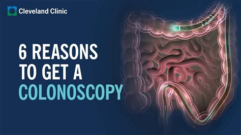 How many years does a colonoscopy last?