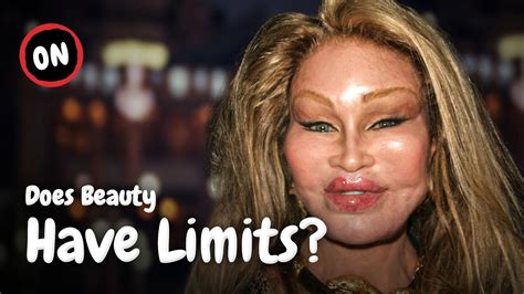 How much Botox is too much?