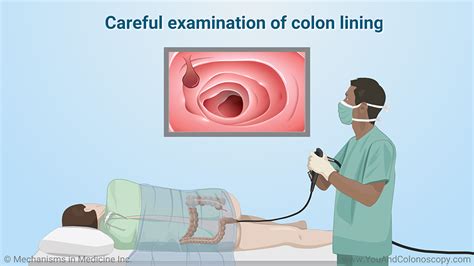How much blood is normal after a colonoscopy?