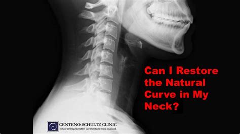 How much curve should your neck have?