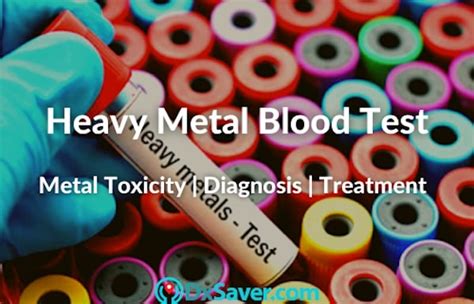 How much does a heavy metal toxicity test cost?