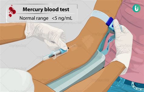 How much does a mercury blood test cost?