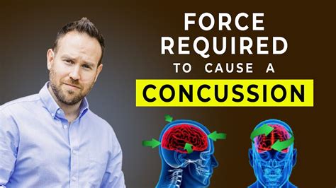 How much force does it take to get a concussion?
