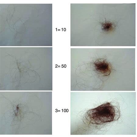 How much hair is normal to lose daily?