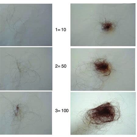 How much hair loss is normal?