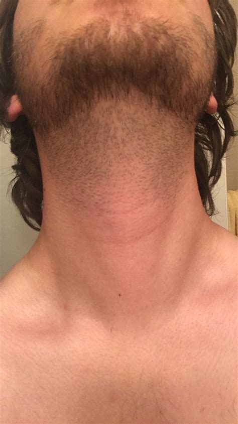 How much neck hair should you shave?